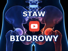 Rehabilitacja Lubartów - staw biodrowy